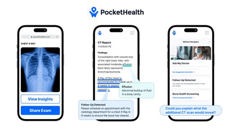 Pocket Health